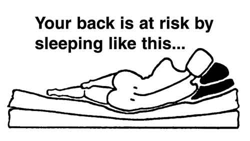 sagging mattress causing backpain